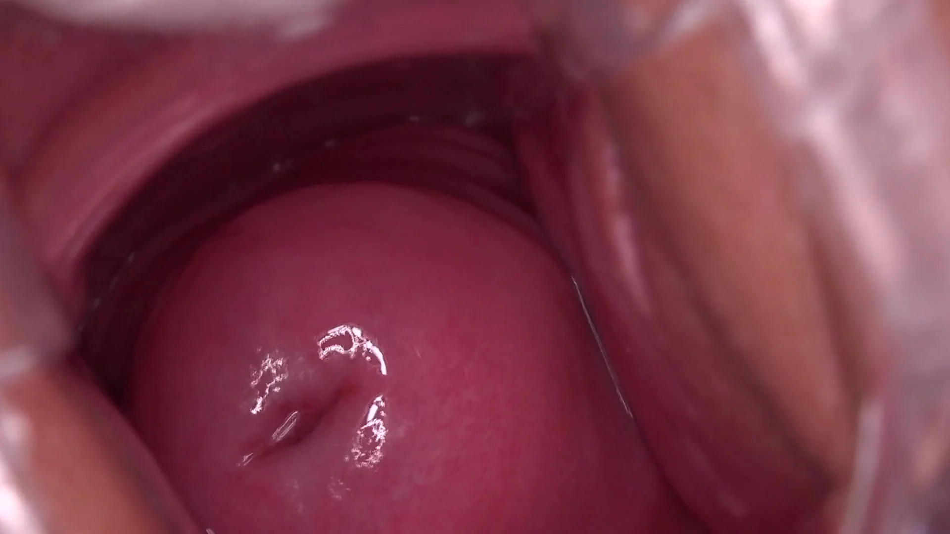 contractions Video cervix orgasm dip